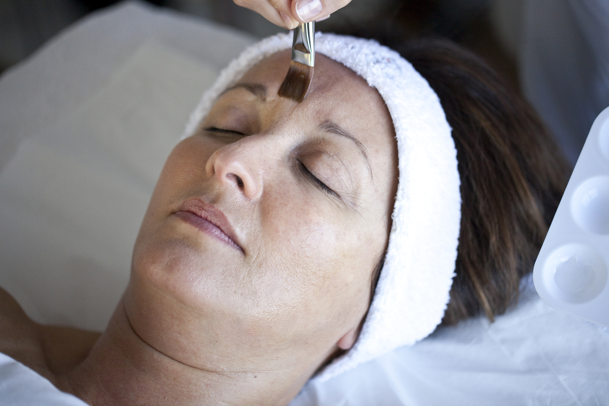 Image of lady having a professional peel applied