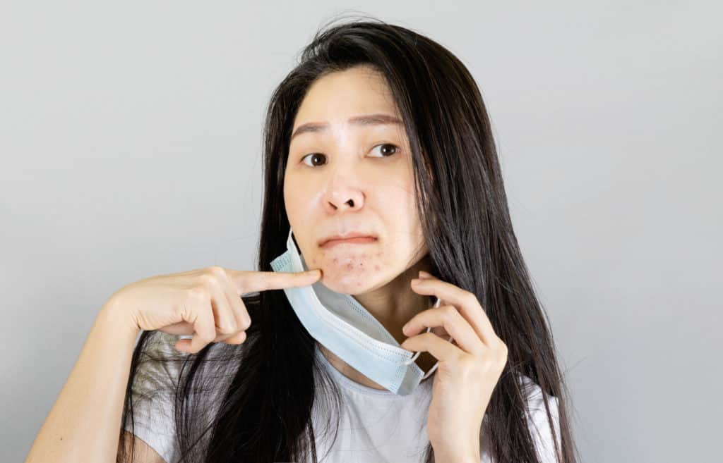 Woman examining blemish-prone problem skin in the mirror